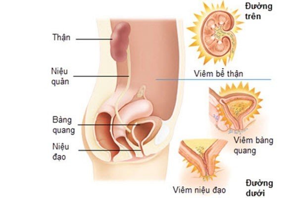 Quả việt quất có tác dụng ngăn ngừa nhiễm trùng đường tiết niệu